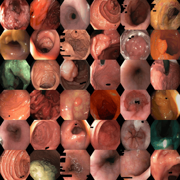 Unconditional samples generated by REVEAL, showing realistic mucosal texture and specular highlights.