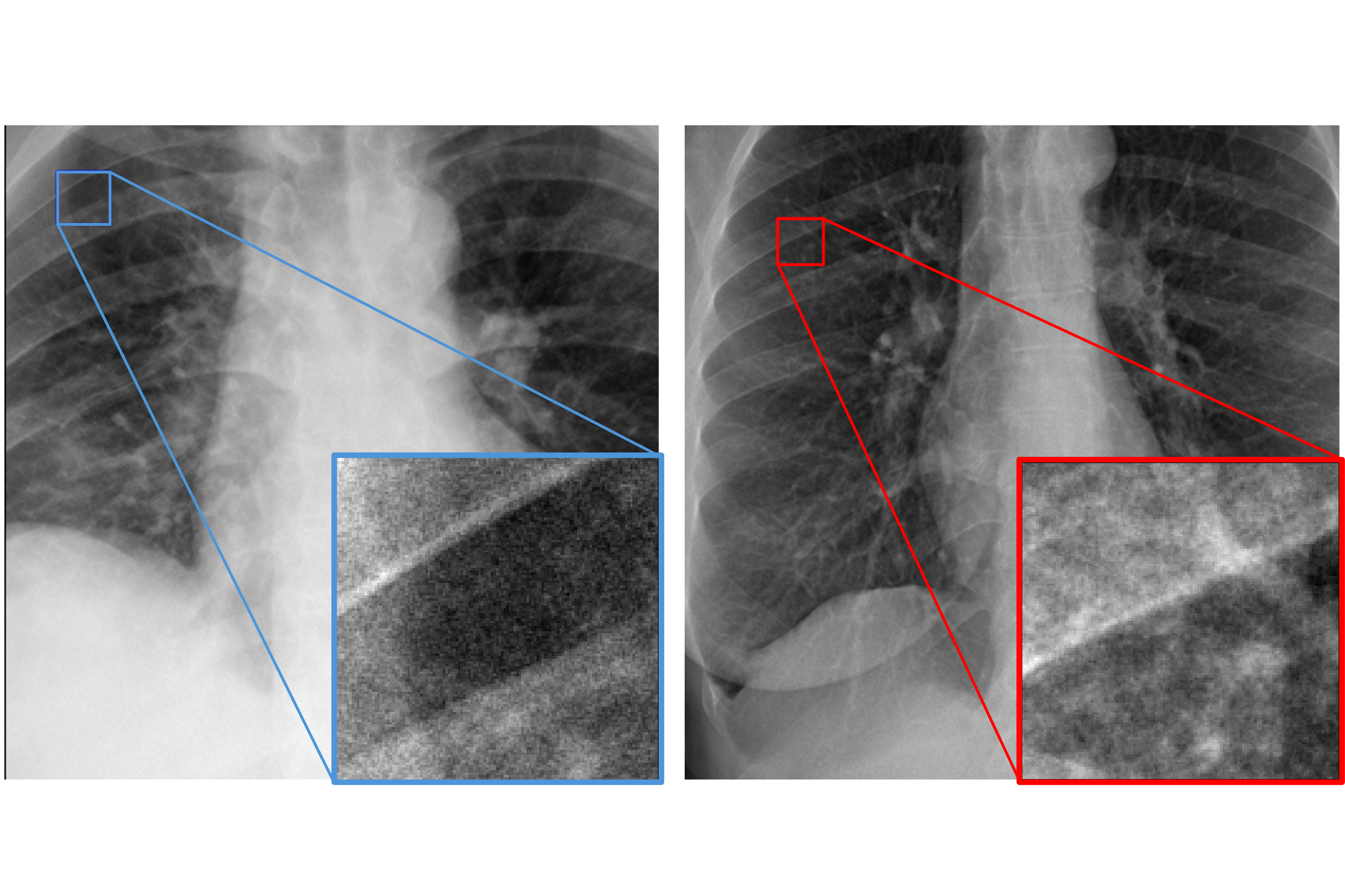 AdverX-Ray